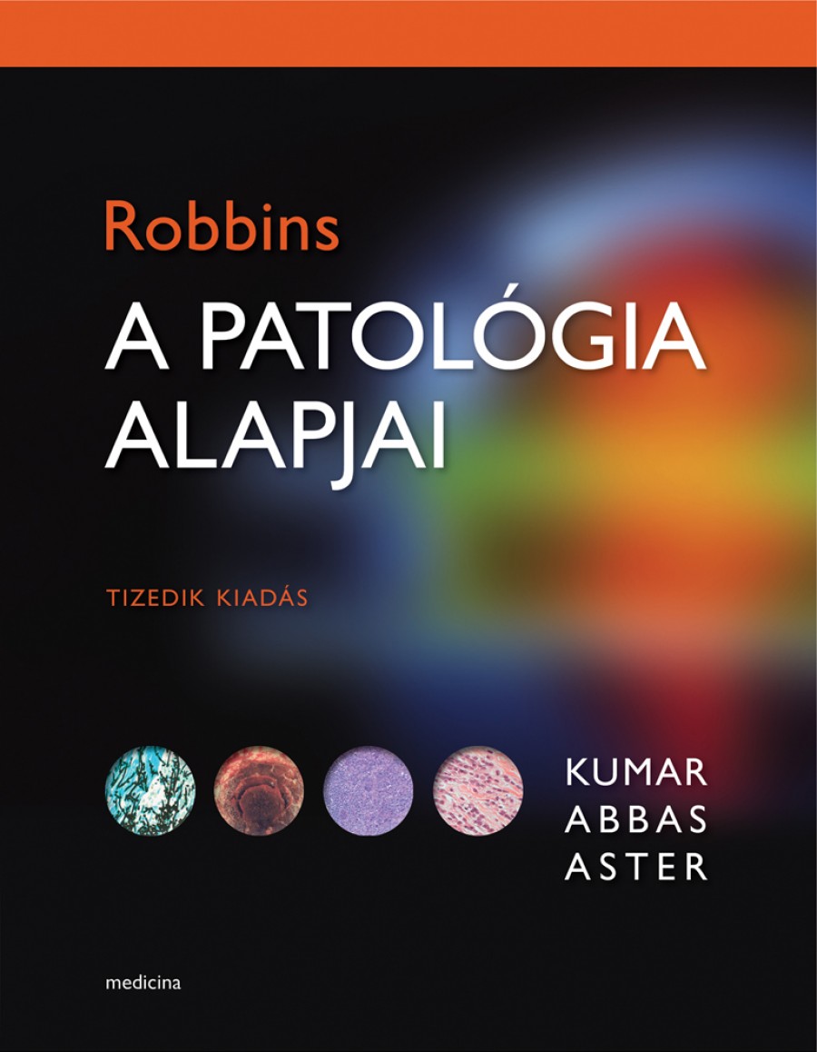 ROBBINS A patológia alapjai 10. kiadás | Patológia | Medicina Könyvkiadó  Webshop