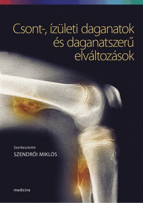 ízületi ízületi elváltozások)
