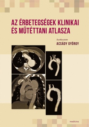 Az érbetegségek klinikai és műtéttani atlasza 1753