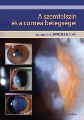 A szemfelszín és a cornea betegségei 2214