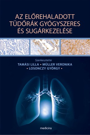 Az előrehaladott tüdőrák gyógyszeres és sugárkezelése 2465